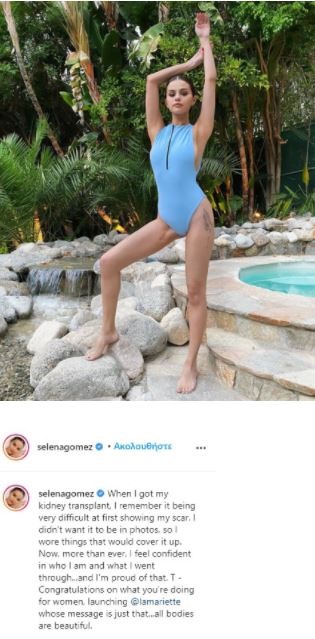 Ανάρτηση στο Instagram από τη Σελένα Γκόμεζ με την ουλή από μεταμόσχευση νεφρού